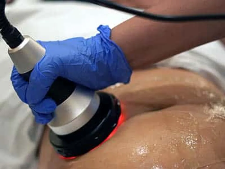 Cellulite Reduction Treatment