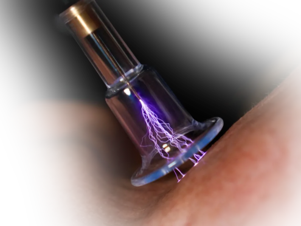 Cold Atmospheric Plasma (CAP) Treatment