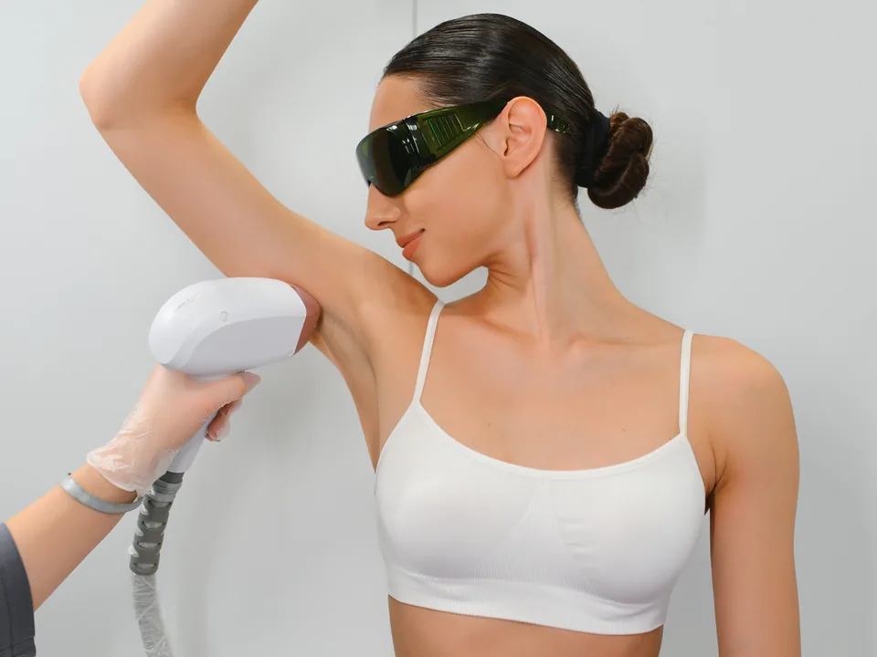 Laser Hair Removal UK | Permanent Results | VIVO Body Studio