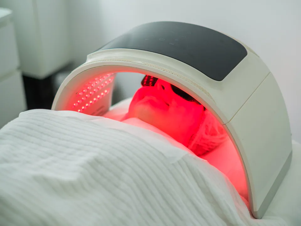 LED Light Therapy for Acne