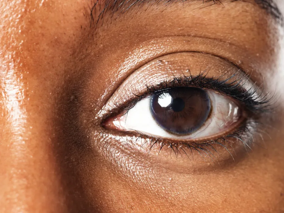 Plasma Eye Lift