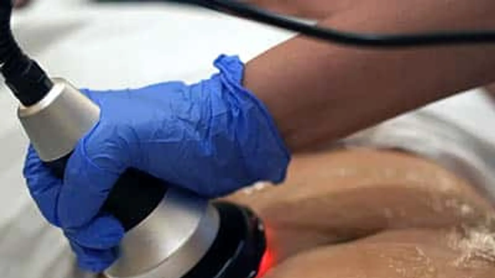 Cellulite Reduction Treatment video thumbnail