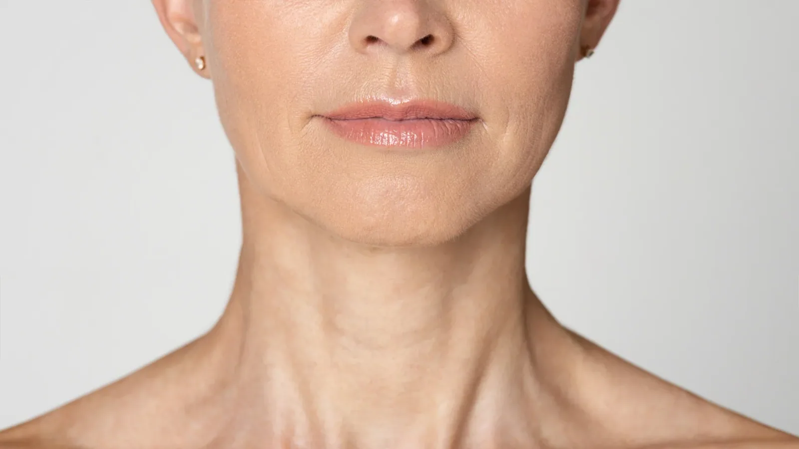 Radio Frequency Face Lift treatment