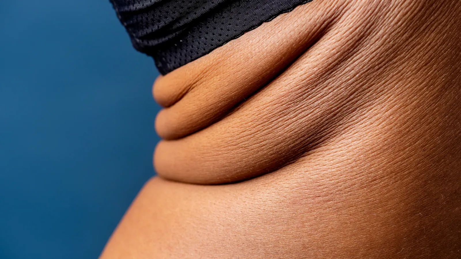 Radio Frequency Body Tightening: Non-Surgical Skin Tightening Treatment treatment