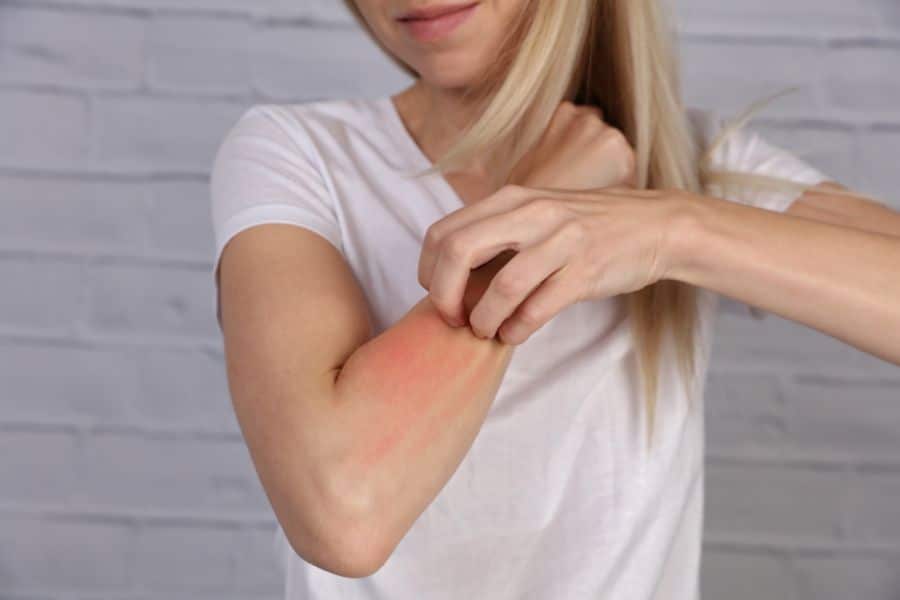 A Woman Scratching her Arm