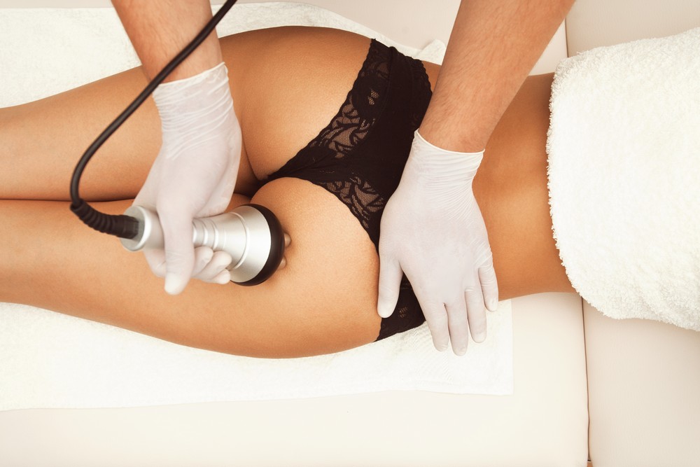 Ultrasound Cavitation performed on the Buttock