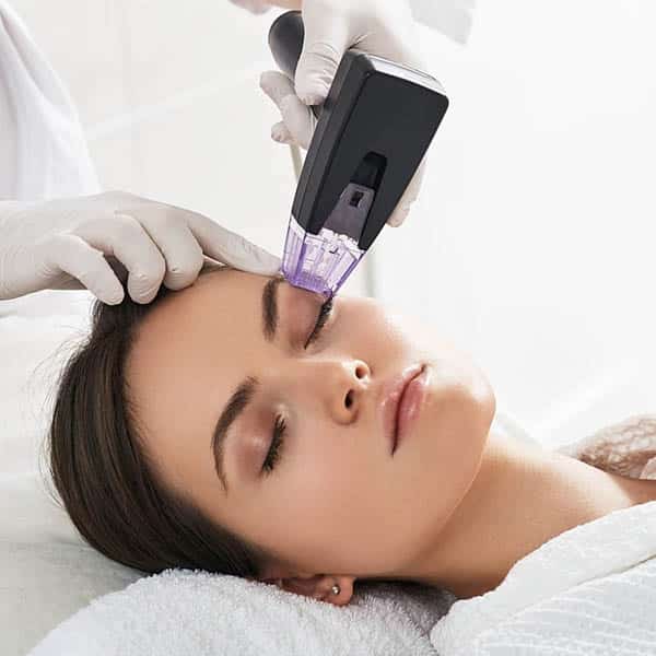 Morpheus Radiofrequency Microneedling, Morpheus8 Birmingham, Morpheus8 in Birmingham