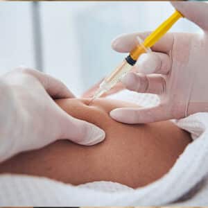 Aqualyx Fat Dissolving Injections