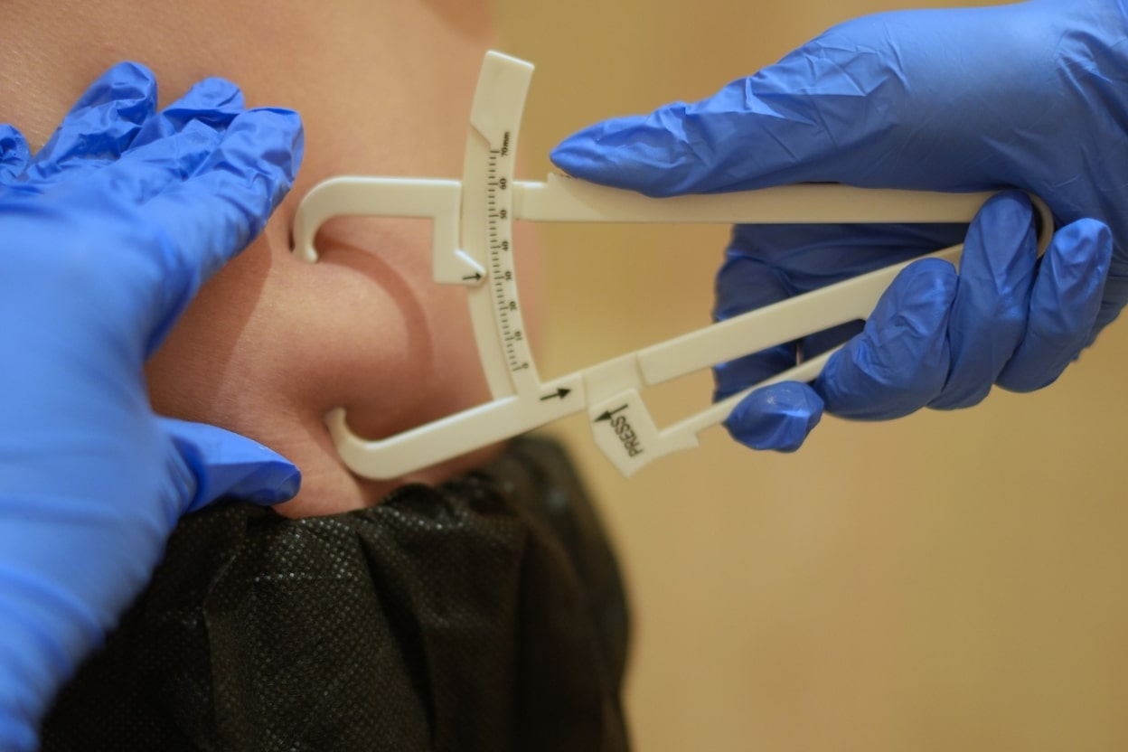 Clinical Measurement Of Fat Thickness