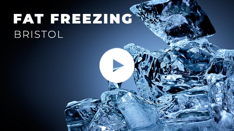 Fat Freezing Bristol video thumbnail