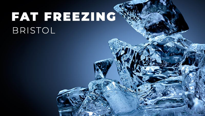 Fat Freezing Bristol
