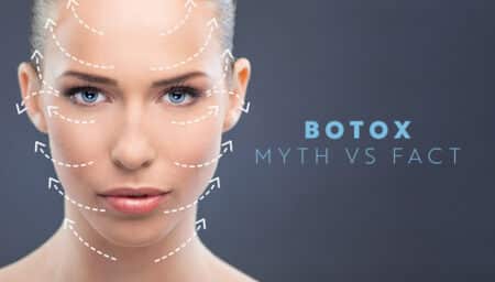 BOTOX – Myth Vs Fact
