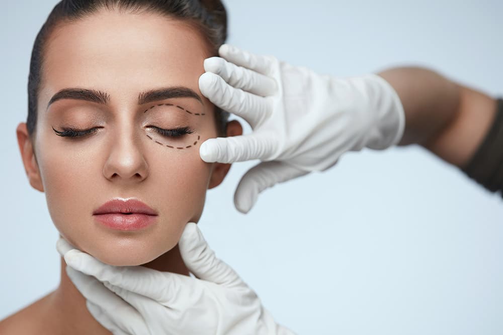 Blepharoplasty