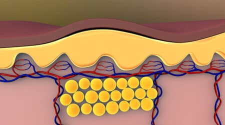 Block Fat Abosorption