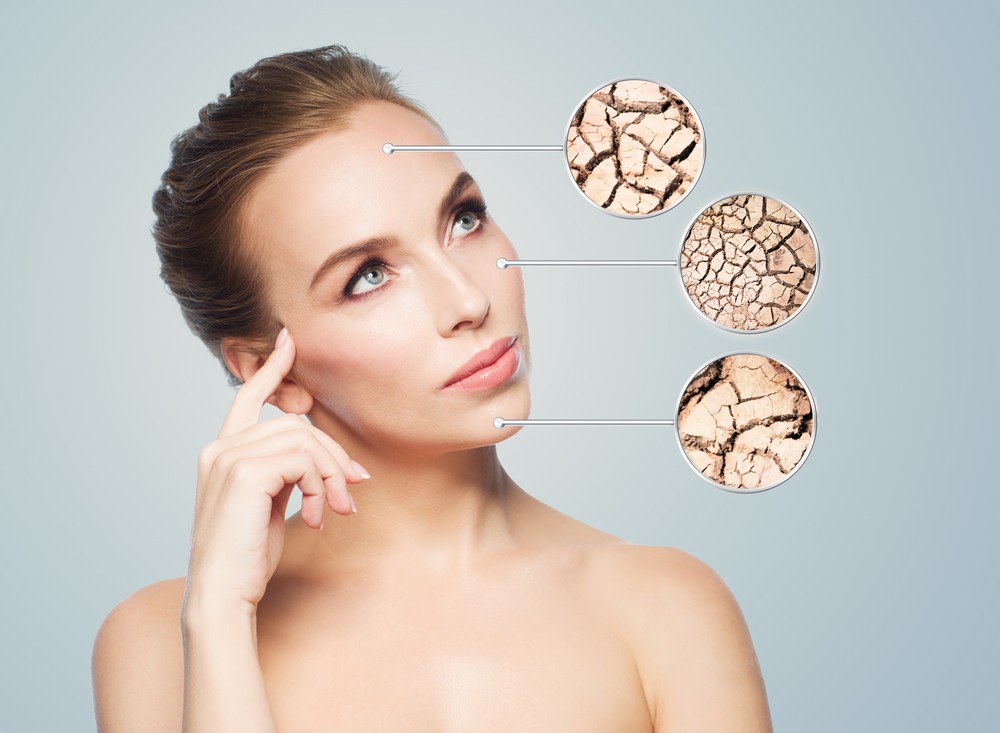 Dry Skin