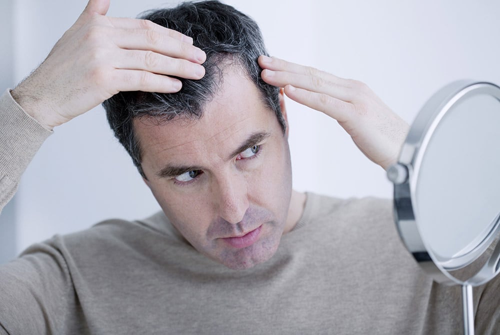 Male Hair Loss: Why Do Men Lose Hair As They Get Older? - VIVO Clinic