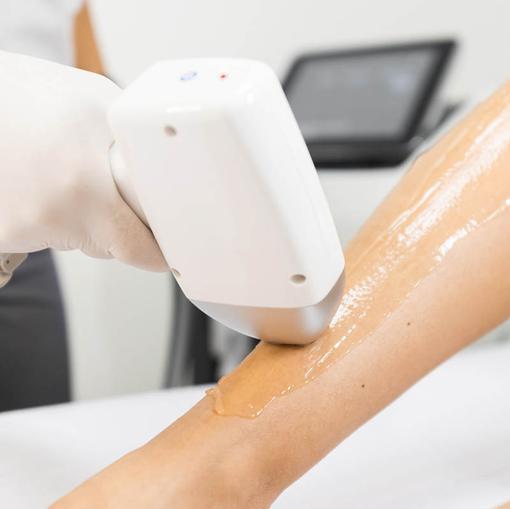 HIFU Facelift - Laser Hair Removal,laser hair removal Dubai,laser hair removal Mumbai