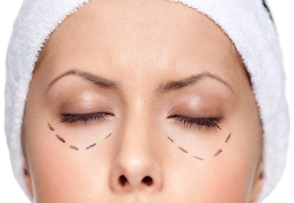 HIFU Facelift - Plasma Eye Lift