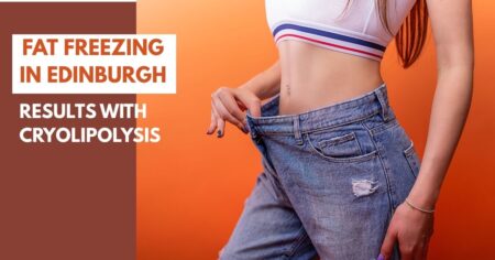 Fat Reduction in Edinburgh