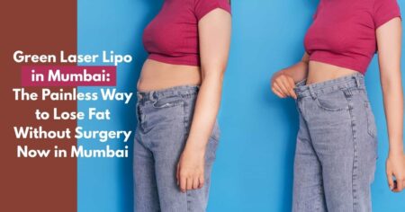 Green Laser Lipo Mumbai