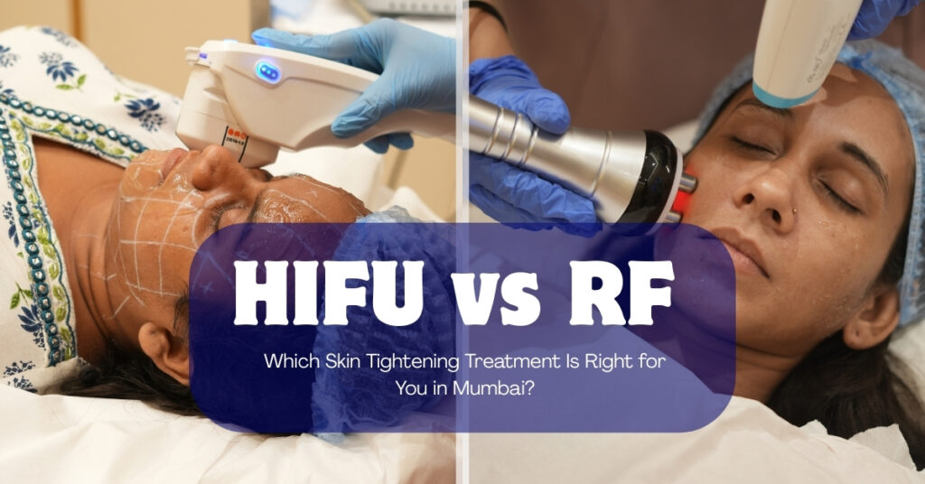 HIFU vs RF: Which Skin Tightening Treatment Is Right for You in Mumbai? 1 hifu vs rf skin tightening, rf vs hifu, hifu treatment mumbai, rf skin tightening treatment, Hifu Vs Rf Skin Tightening