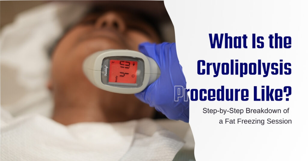 What Is Fat Freezing (Cryolipolysis)