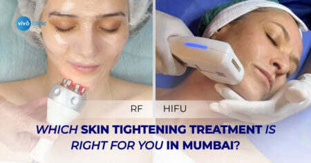 hifu vs rf skin tightening