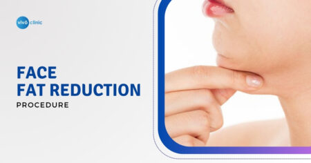 face fat reduction procedures