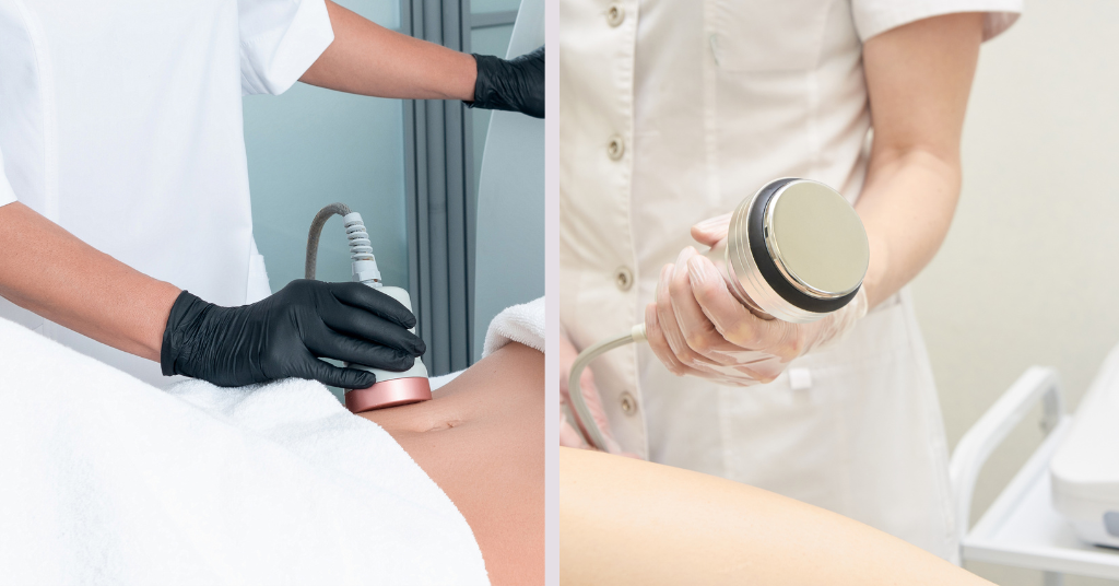 Supersonic Cavitation: Ultrasonic Fat Reduction