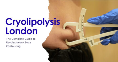 Cryolipolysis London